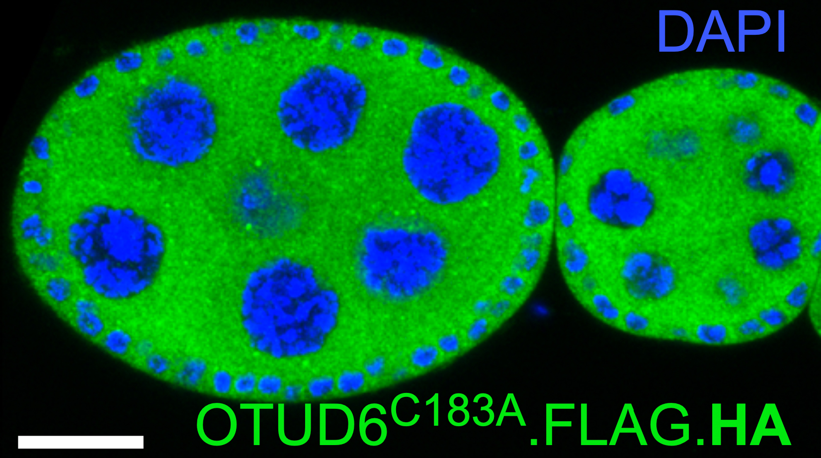 OTUD6 regulates translation